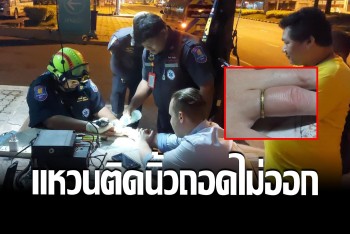 หนุ่มเบลเยี่ยมสุดปวด นิ้วบวมติดแหวน รีบบึ่งเก๋งหากู้ภัยช่วยตัดออก